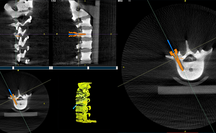 機器人手術系統(tǒng)3D影像