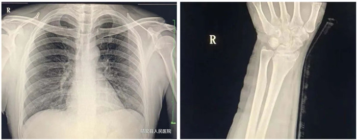 動態DR影像 動態DR影像