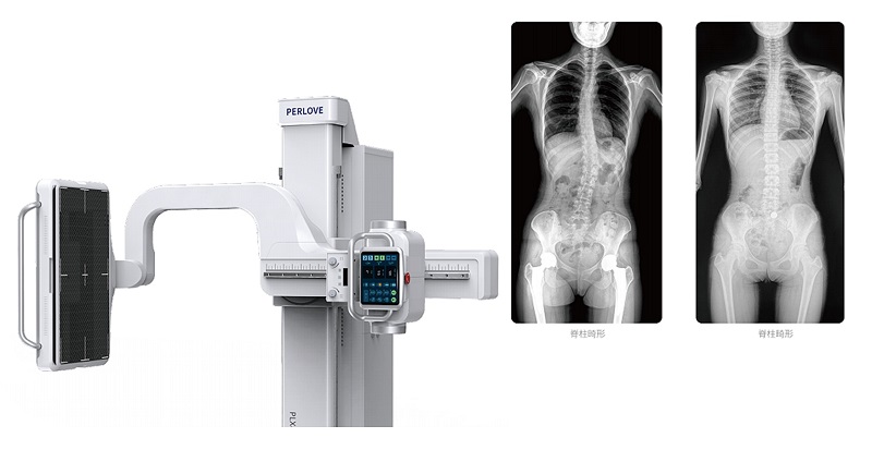 動(dòng)態(tài)DR脊柱拍片